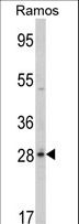 PGLS / 6PGL Antibody - Western blot of PGLS Antibody in Ramos cell line lysates (35 ug/lane). PGLS (arrow) was detected using the purified antibody.