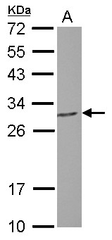 PGLS / 6PGL Antibody - Sample (30 ug of whole cell lysate) A: SK-N-SH 12% SDS PAGE PGLS antibody diluted at 1:5000