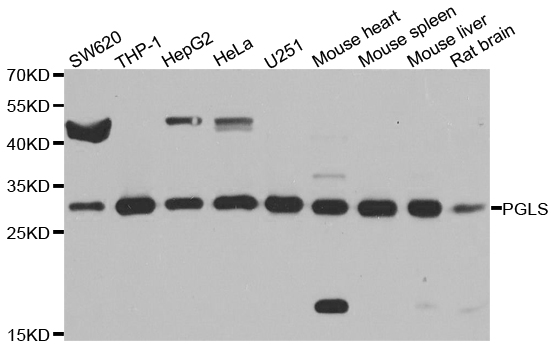 PGLS / 6PGL Antibody - Western blot analysis of extracts of various cell lines.