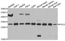 PGLS / 6PGL Antibody - Western blot analysis of extracts of various cell lines.