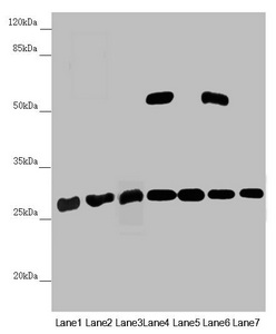 PGLS / 6PGL Antibody - Western blot All Lanes:PGLS antibody at 3.94 ug/ml Lane 1: Mouse heart tissue Lane 2: Mouse liver tissue Lane 3: Mouse brain tissue Lane 4: U251 whole cell lysate Lane 5: Thp-1 whole cell lysate Lane 6: HepG-2 whole cell lysate Lane 7: Hela whole cell lysate Secondary Goat polyclonal to rabbit IgG at 1/10000 dilution Predicted band size: 28 kDa Observed band size: 28,52 kDa