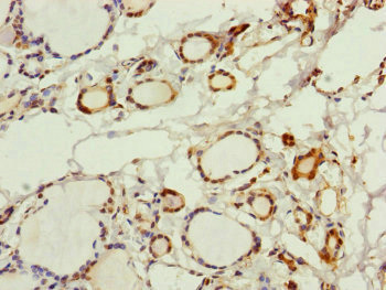 PGLS / 6PGL Antibody - Immunohistochemistry of paraffin-embedded human thyroid tissue at dilution of 1:100