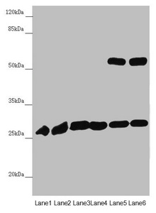 PGLS / 6PGL Antibody - Western blot All Lanes:PGLS antibody at 4.19 ug/ml Lane 1: Mouse liver tissue Lane 2: Mouse brain tissue Lane 3: U251 whole cell lysate Lane 4: Thp-1 whole cell lysate Lane 5: HepG-2 whole cell lysate Lane 6: Hela whole cell lysate Secondary Goat polyclonal to rabbit IgG at 1/10000 dilution Predicted band size: 28 kDa Observed band size: 28,52 kDa