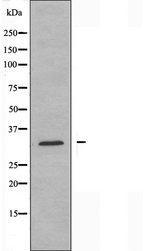 PGLS / 6PGL Antibody - Western blot analysis of extracts of COLO cells using PGLS antibody.