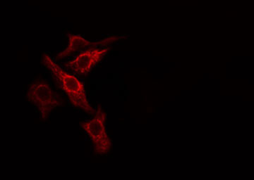 PGLS / 6PGL Antibody - Staining COLO205 cells by IF/ICC. The samples were fixed with PFA and permeabilized in 0.1% Triton X-100, then blocked in 10% serum for 45 min at 25°C. The primary antibody was diluted at 1:200 and incubated with the sample for 1 hour at 37°C. An Alexa Fluor 594 conjugated goat anti-rabbit IgG (H+L) antibody, diluted at 1/600, was used as secondary antibody.