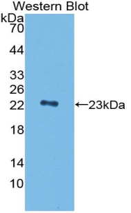 PGLYRP1 / PGRP Antibody - Western blot of recombinant PGLYRP1 / PGRP.