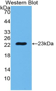 PGLYRP1 / PGRP Antibody - Western blot of recombinant PGLYRP1 / PGRP.