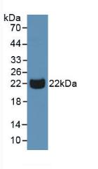 PGLYRP1 / PGRP Antibody - Western Blot; Sample: Human Urine.