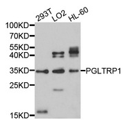 PGLYRP1 / PGRP Antibody - Western blot analysis of extracts of various cell lines, using PGLYRP1 antibody at 1:1000 dilution. The secondary antibody used was an HRP Goat Anti-Rabbit IgG (H+L) at 1:10000 dilution. Lysates were loaded 25ug per lane and 3% nonfat dry milk in TBST was used for blocking. An ECL Kit was used for detection and the exposure time was 5s.
