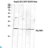 PGLYRP1 / PGRP Antibody - Western Blot (WB) analysis of HepG2 823-AV 293T AD293 HeLa lysis using PGLYRP1 antibody.