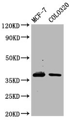 PGLYRP3 Antibody - Western Blot Positive WB detected in: MCF-7 whole cell lysate, COLO320 whole cell lysate All Lanes: PGLYRP3 antibody at 4.86µg/ml Secondary Goat polyclonal to rabbit IgG at 1/50000 dilution Predicted band size: 38 KDa Observed band size: 38 KDa