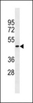 PGLYRP4 Antibody - PGLYRP4 Antibody western blot of A549 cell line lysates (35 ug/lane). The PGLYRP4 antibody detected the PGLYRP4 protein (arrow).
