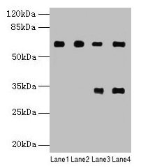 PGM1 / Phosphoglucomutase 1 Antibody - Western blot All lanes: PGM1 antibody at 6µg/ml Lane 1: U251 whole cell lysate Lane 2: U937 whole cell lysate Lane 3: Jurkat whole cell lysate Lane 4: Hela whole cell lysate Secondary Goat polyclonal to rabbit IgG at 1/10000 dilution Predicted band size: 62, 64, 41 kDa Observed band size: 62, 33 kDa