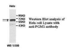 PGM1 / Phosphoglucomutase 1 Antibody