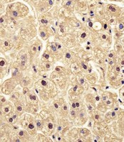 PGM1 / Phosphoglucomutase 1 Antibody - Antibody staining PGM1 in human liver tissue sections by Immunohistochemistry (IHC-P - paraformaldehyde-fixed, paraffin-embedded sections). Tissue was fixed with formaldehyde and blocked with 3% BSA for 0. 5 hour at room temperature; antigen retrieval was by heat mediation with a citrate buffer (pH 6). Samples were incubated with primary antibody (1:25) for 1 hours at 37°C. A undiluted biotinylated goat polyvalent antibody was used as the secondary antibody.