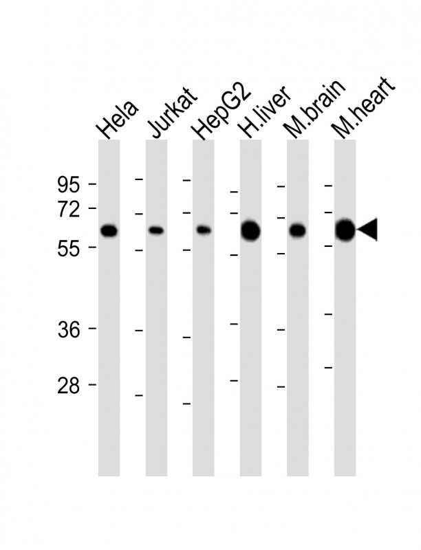 PGM1 / Phosphoglucomutase 1 Antibody - All lanes: Anti-PGM1 Antibody (Center) at 1:2000 dilution. Lane 1: HeLa whole cell lysate. Lane 2: Jurkat whole cell lysate. Lane 3: HepG2 whole cell lysate. Lane 4: human liver lysate. Lane 5: mouse brain lysate. Lane 6: mouse heart lysate Lysates/proteins at 20 ug per lane. Secondary Goat Anti-Rabbit IgG, (H+L), Peroxidase conjugated at 1:10000 dilution. Predicted band size: 61 kDa. Blocking/Dilution buffer: 5% NFDM/TBST.