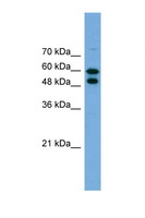PGM1 / Phosphoglucomutase 1 Antibody - PGM1 antibody Western blot of 293T Cell lysate. Antibody concentration 1 ug/ml. This image was taken for the unconjugated form of this product. Other forms have not been tested.