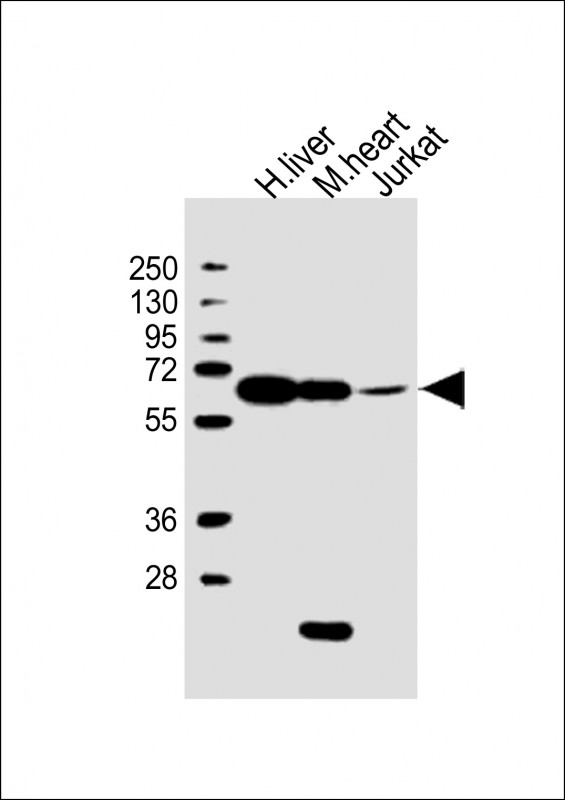 PGM1 / Phosphoglucomutase 1 Antibody - All lanes: Anti-PGM1 Antibody (C-Term) at 1:2000 dilution. Lane 1: human liver lysate. Lane 2: mouse heart lysate. Lane 3: Jurkat whole cell lysate Lysates/proteins at 20 ug per lane. Secondary Goat Anti-Rabbit IgG, (H+L), Peroxidase conjugated at 1:10000 dilution. Predicted band size: 61 kDa. Blocking/Dilution buffer: 5% NFDM/TBST.