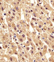 PGM1 / Phosphoglucomutase 1 Antibody - Antibody staining PGM1 in human liver tissue sections by Immunohistochemistry (IHC-P - paraformaldehyde-fixed, paraffin-embedded sections). Tissue was fixed with formaldehyde and blocked with 3% BSA for 0. 5 hour at room temperature; antigen retrieval was by heat mediation with a citrate buffer (pH 6). Samples were incubated with primary antibody (1:25) for 1 hours at 37°C. A undiluted biotinylated goat polyvalent antibody was used as the secondary antibody.