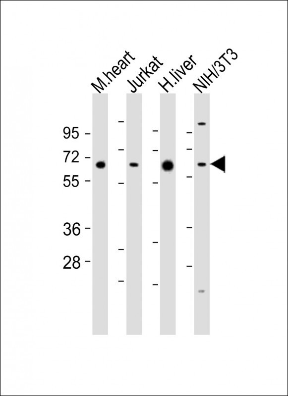 PGM1 / Phosphoglucomutase 1 Antibody - All lanes: Anti-PGM1 Antibody (C-Term) at 1:2000 dilution. Lane 1: mouse heart lysates. Lane 2: Jurkat whole cell lysates. Lane 3: human liver lysates. Lane 4: NIH/3T3 whole cell lysates Lysates/proteins at 20 ug per lane. Secondary Goat Anti-Rabbit IgG, (H+L), Peroxidase conjugated at 1:10000 dilution. Predicted band size: 61 kDa. Blocking/Dilution buffer: 5% NFDM/TBST.