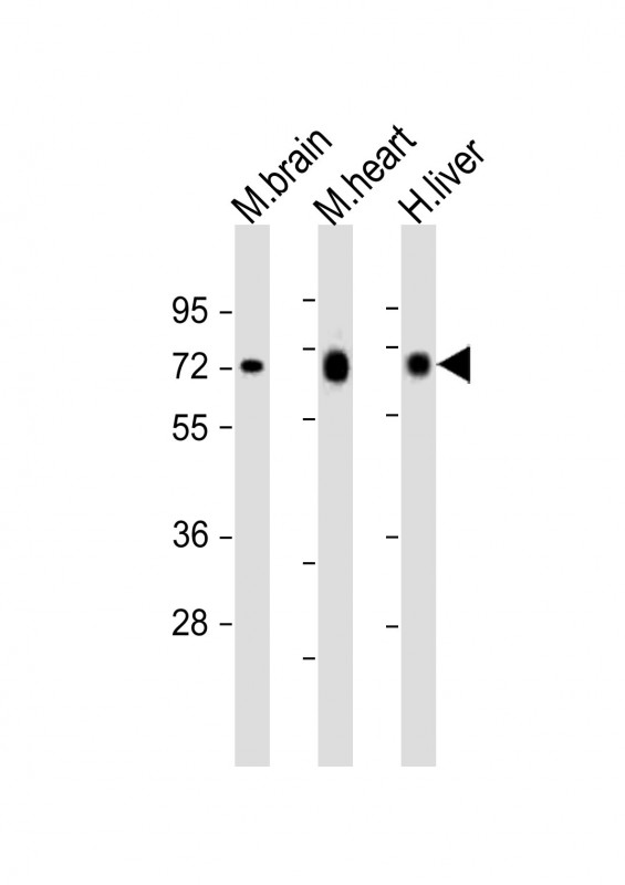 PGM1 / Phosphoglucomutase 1 Antibody - All lanes: Anti-PGM1 Antibody (C-Term) at 1:2000 dilution. Lane 1: mouse brain lysates. Lane 2: mouse heart lysates. Lane 3: human liver lysates Lysates/proteins at 20 ug per lane. Secondary Goat Anti-Rabbit IgG, (H+L), Peroxidase conjugated at 1:10000 dilution Predicted band size: 61 kDa. Blocking/Dilution buffer: 5% NFDM/TBST.