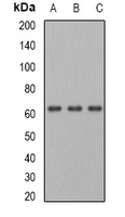 PGM1 / Phosphoglucomutase 1 Antibody - Western blot analysis of PGM1 expression in HepG2 (A); mouse heart (B); rat liver (C) whole cell lysates.