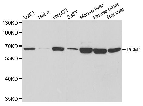 PGM1 / Phosphoglucomutase 1 Antibody - Western blot analysis of extracts of various cell lines, using PGM1 antibody at 1:1000 dilution. The secondary antibody used was an HRP Goat Anti-Rabbit IgG (H+L) at 1:10000 dilution. Lysates were loaded 25ug per lane and 3% nonfat dry milk in TBST was used for blocking. An ECL Kit was used for detection and the exposure time was 90s.