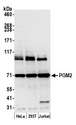 PGM2 Antibody - Detection of human PGM2 by western blot. Samples: Whole cell lysate (15 µg) from HeLa, HEK293T, and Jurkat cells prepared using NETN lysis buffer. Antibody: Affinity purified rabbit anti-PGM2 antibody used for WB at 0.1 µg/ml. Detection: Chemiluminescence with an exposure time of 30 seconds.