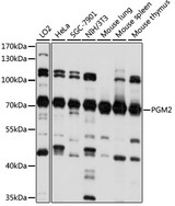 PGM2 Antibody - Western blot analysis of extracts of various cell lines, using PGM2 antibody at 1:1000 dilution. The secondary antibody used was an HRP Goat Anti-Rabbit IgG (H+L) at 1:10000 dilution. Lysates were loaded 25ug per lane and 3% nonfat dry milk in TBST was used for blocking. An ECL Kit was used for detection and the exposure time was 10s.