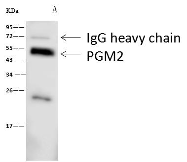 PGM2 Antibody - H3A was immunoprecipitated using: Lane A: 0.5 mg Hela Whole Cell Lysate. 1 uL anti-H3A rabbit polyclonal antibody and 60 ug of Immunomagnetic beads Protein A/G. Primary antibody: Anti-H3A rabbit polyclonal antibody, at 1:500 dilution. Secondary antibody: Goat Anti-Rabbit IgG (H+L)/HRP at 1/10000 dilution. Developed using the ECL technique. Performed under reducing conditions. Predicted band size: 15 kDa. Observed band size: 15 kDa.