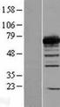 PGM2 Protein - Western validation with an anti-DDK antibody * L: Control HEK293 lysate R: Over-expression lysate