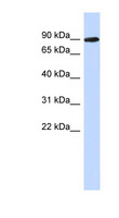 PGM2L1 Antibody - PGM2L1 antibody Western blot of Placenta lysate. This image was taken for the unconjugated form of this product. Other forms have not been tested.