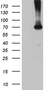 PGM2L1 Antibody - HEK293T cells were transfected with the pCMV6-ENTRY control. (Left lane) or pCMV6-ENTRY PGM2L1. (Right lane) cDNA for 48 hrs and lysed