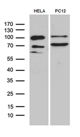 PGM2L1 Antibody - Western blot analysis of extracts. (35ug) from 2 cell lines by using anti-PGM2L1 monoclonal antibody. (1:500)