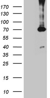 PGM2L1 Antibody - HEK293T cells were transfected with the pCMV6-ENTRY control. (Left lane) or pCMV6-ENTRY PGM2L1. (Right lane) cDNA for 48 hrs and lysed