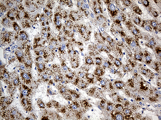 PGM2L1 Antibody - Immunohistochemical staining of paraffin-embedded Human liver tissue within the normal limits using anti-PGM2L1 mouse monoclonal antibody. (Heat-induced epitope retrieval by 1mM EDTA in 10mM Tris buffer. (pH8.5) at 120°C for 3 min. (1:500)