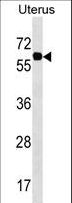 PGM3 Antibody - PGM3 Antibody western blot of Uterus tissue lysates (35 ug/lane). The PGM3 antibody detected the PGM3 protein (arrow).
