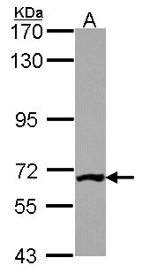 PGM3 Antibody - Sample (30 ug of whole cell lysate). A: JurKat. 7.5% SDS PAGE. PGM3 antibody diluted at 1:1000.