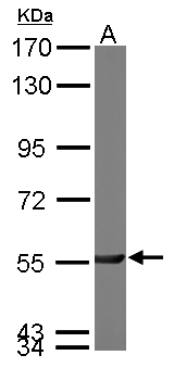 PGM3 Antibody - Sample (50 ug of whole cell lysate). A: mouse brain. 7.5% SDS PAGE. PGM3 antibody diluted at 1:3000.