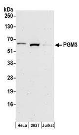 PGM3 Antibody - Detection of human PGM3 by western blot. Samples: Whole cell lysate (50 µg) from HeLa, HEK293T, and Jurkat cells prepared using NETN lysis buffer. Antibodies: Affinity purified rabbit anti-PGM3 antibody used for WB at 0.1 µg/ml. Detection: Chemiluminescence with an exposure time of 3 minutes.