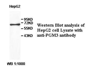 PGM3 Antibody