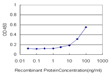 PGM3 Antibody - Detection limit for recombinant GST tagged PGM3 is approximately 3 ng/ml as a capture antibody.