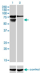 PGM3 Antibody - Western blot of PGM3 over-expressed 293 cell line, cotransfected with PGM3 Validated Chimera RNAi (Lane 2) or non-transfected control (Lane 1). Blot probed with PGM3 monoclonal antibody, clone 1E2-1B12. GAPDH ( 36.1 kD ) used as specific.