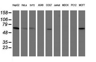PGM3 Antibody - Western blot of extracts (35 ug) from 9 different cell lines by using g anti-PGM3 monoclonal antibody (HepG2: human; HeLa: human; SVT2: mouse; A549: human; COS7: monkey; Jurkat: human; MDCK: canine; PC12: rat; MCF7: human).