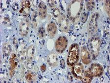 PGM3 Antibody - IHC of paraffin-embedded Human Kidney tissue using anti-PGM3 mouse monoclonal antibody.