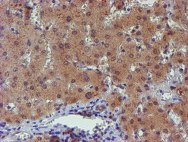 PGM3 Antibody - IHC of paraffin-embedded Human liver tissue using anti-PGM3 mouse monoclonal antibody.