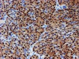 PGM3 Antibody - IHC of paraffin-embedded Human pancreas tissue using anti-PGM3 mouse monoclonal antibody.