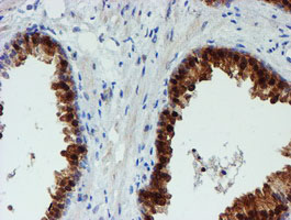PGM3 Antibody - IHC of paraffin-embedded Human prostate tissue using anti-PGM3 mouse monoclonal antibody.