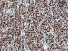 PGM3 Antibody - IHC of paraffin-embedded Human pancreas tissue using anti-PGM3 mouse monoclonal antibody. (Heat-induced epitope retrieval by 10mM citric buffer, pH6.0, 100C for 10min).
