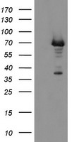 PGM3 Antibody - HEK293T cells were transfected with the pCMV6-ENTRY control (Left lane) or pCMV6-ENTRY PGM3 (Right lane) cDNA for 48 hrs and lysed. Equivalent amounts of cell lysates (5 ug per lane) were separated by SDS-PAGE and immunoblotted with anti-PGM3.